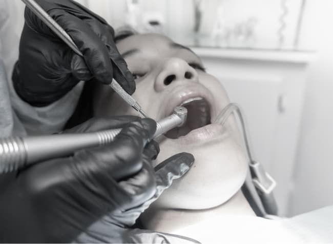 Dental Instruments